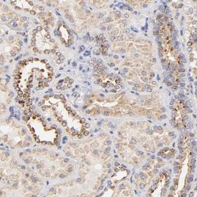 Immunohistochemistry-Paraffin: FMNL3 Antibody [NBP1-84092]