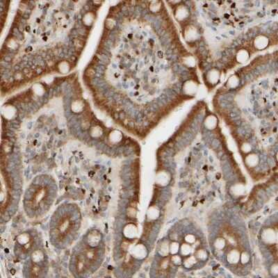 Immunohistochemistry-Paraffin: FMO1 Antibody [NBP1-86412]