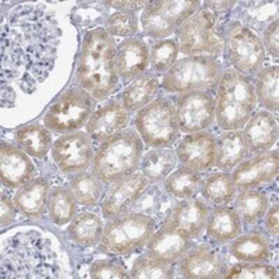 Immunohistochemistry-Paraffin: FMO1 Antibody [NBP3-17848]