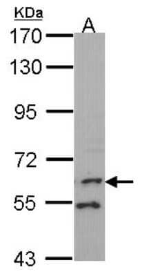 Western Blot: FMO1 Antibody [NBP2-16511]