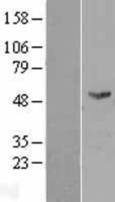 Western Blot: FMO2 Overexpression Lysate [NBL1-10776]