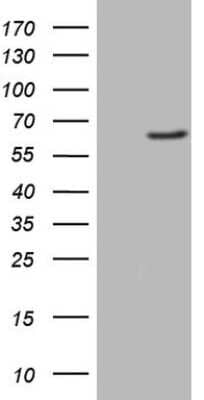 Western Blot: FMO3 Antibody (OTI3H1) [NBP2-45668]