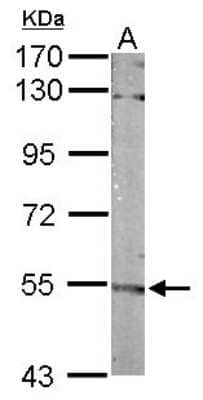 Western Blot: FMO3 Antibody [NBP1-33583]