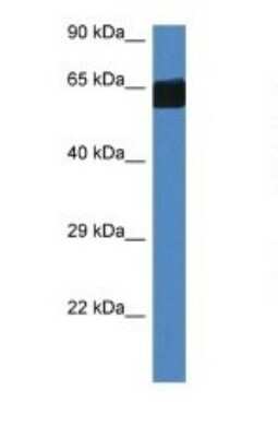 Western Blot: FMO3 Antibody [NBP1-82415]