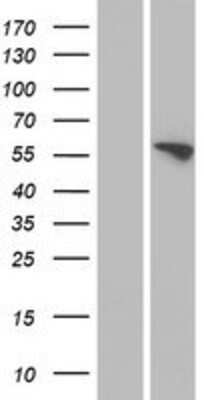 Western Blot: FMO3 Overexpression Lysate [NBP2-07563]