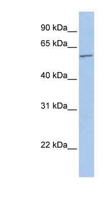 Western Blot: FMO5 Antibody [NBP1-59731]