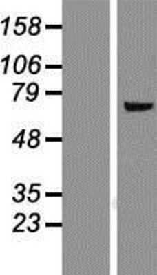 Western Blot: FMO5 Overexpression Lysate [NBP2-08206]