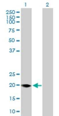 Western Blot: FMO9P Antibody [H00116123-B01P]