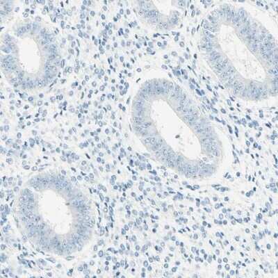 Immunohistochemistry-Paraffin: FMR1NB Antibody [NBP1-85403]