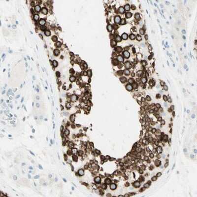 Immunohistochemistry-Paraffin: FMR1NB Antibody [NBP1-85403]