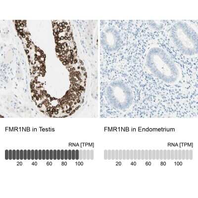 Immunohistochemistry-Paraffin: FMR1NB Antibody [NBP1-85403]