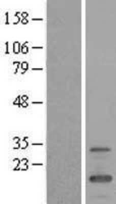 Western Blot: FMR1NB Overexpression Lysate [NBL1-10779]