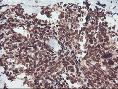 Immunohistochemistry-Paraffin: FMRP Antibody (OTI1C6) [NBP2-01770]
