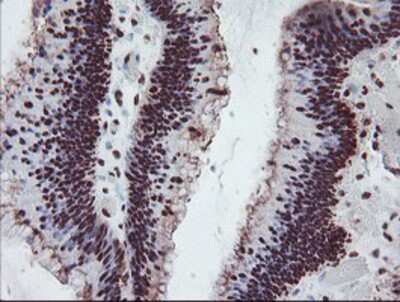 Immunohistochemistry-Paraffin: FMRP Antibody (OTI1C6) [NBP2-01770]