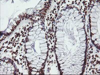 Immunohistochemistry-Paraffin: FMRP Antibody (OTI1C6) [NBP2-01770]