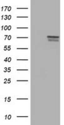 Western Blot: FMRP Antibody (OTI1C6) [NBP2-01770]