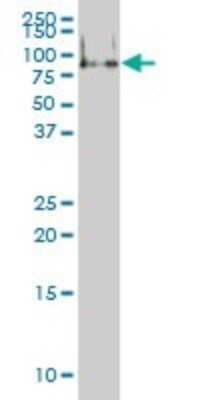 Western Blot: FMRP Antibody (2D4) [H00002332-M01]