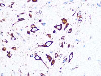Immunohistochemistry-Paraffin: FMRP Antibody (4Y8I5) [NBP3-16431]
