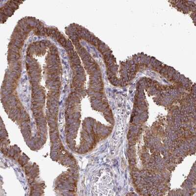 Immunohistochemistry-Paraffin: FMRP Antibody [NBP2-38617]