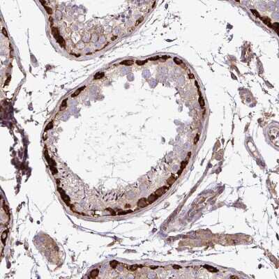 Immunohistochemistry-Paraffin: FMRP Antibody [NBP2-38617]