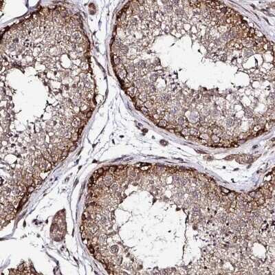Immunohistochemistry-Paraffin: FMRP Antibody [NBP2-38783]