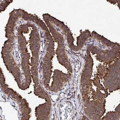 Immunohistochemistry-Paraffin: FMRP Antibody [NBP2-38783]