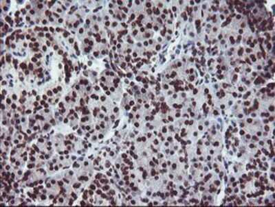 Immunohistochemistry: FMRP Antibody (OTI1C6) - Azide and BSA Free [NBP2-70756]