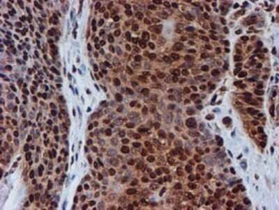 Immunohistochemistry: FMRP Antibody (OTI3B4) - Azide and BSA Free [NBP2-70761]
