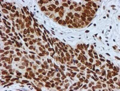 Immunohistochemistry: FMRP Antibody (OTI3B4) - Azide and BSA Free [NBP2-70761]