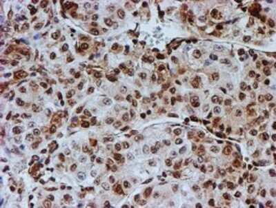 Immunohistochemistry: FMRP Antibody (OTI3B4) [NBP2-45689]