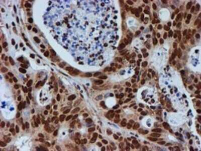 Immunohistochemistry: FMRP Antibody (OTI3B4) [NBP2-45689]