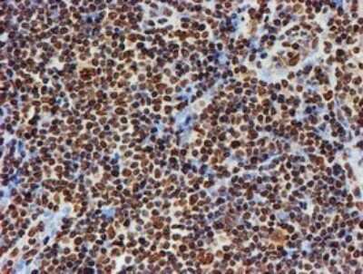 Immunohistochemistry: FMRP Antibody (OTI3B4) [NBP2-45689]