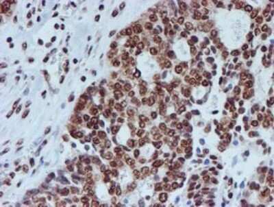 Immunohistochemistry: FMRP Antibody (OTI3B4) [NBP2-45689]