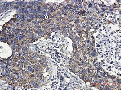 Immunohistochemistry-Paraffin: FMRP Antibody (S08-5G5) [NBP3-19487]