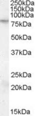 Western Blot: FMRP Antibody [NBP1-20918]