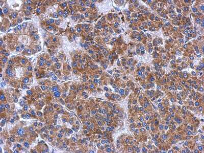 Immunohistochemistry-Paraffin: FN3K Antibody [NBP2-14959]