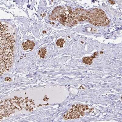 Immunohistochemistry-Paraffin: FN3K Antibody [NBP2-32349]