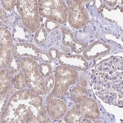 Immunohistochemistry-Paraffin: FN3K Antibody [NBP2-32349]