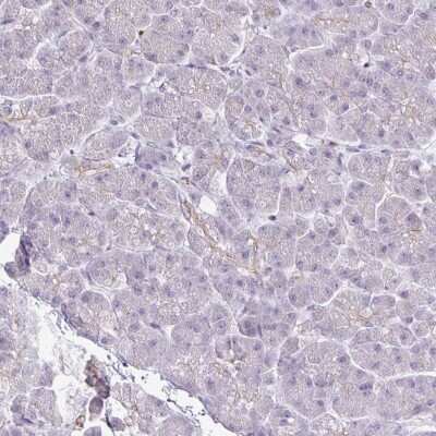 Immunohistochemistry-Paraffin: FN3K Antibody [NBP2-32349]