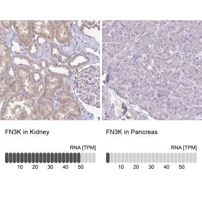 Immunohistochemistry-Paraffin: FN3K Antibody [NBP2-32349]