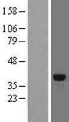 Western Blot: FN3K Overexpression Lysate [NBL1-10780]