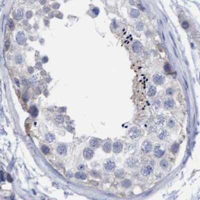 Immunohistochemistry-Paraffin: FNBP1 Antibody [NBP2-62603]