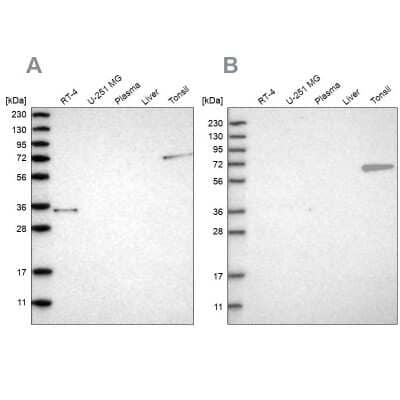 Western Blot: FNBP1 Antibody [NBP2-48542]