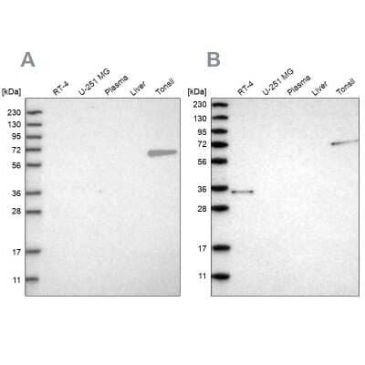 Western Blot: FNBP1 Antibody [NBP2-48556]