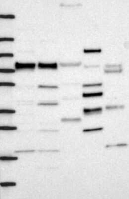 Western Blot: FNBP1 Antibody [NBP3-17252]