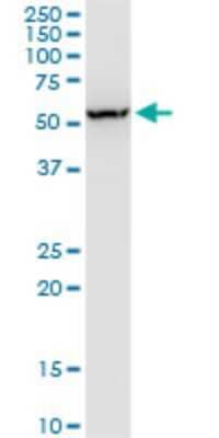 Western Blot: FNBP1L Antibody (1E6) [H00054874-M01]