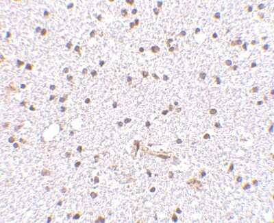 Immunohistochemistry-Paraffin: FNBP1L Antibody - BSA Free [NBP1-76845]