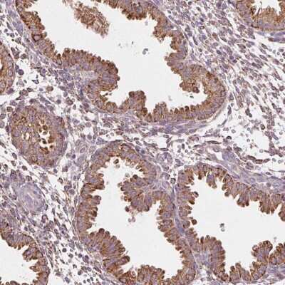Immunohistochemistry-Paraffin: FNBP1L Antibody [NBP2-49439]