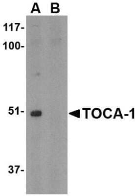 Western Blot: FNBP1L AntibodyBSA Free [NBP1-76845]