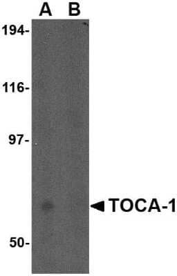 Western Blot: FNBP1L AntibodyBSA Free [NBP1-76846]